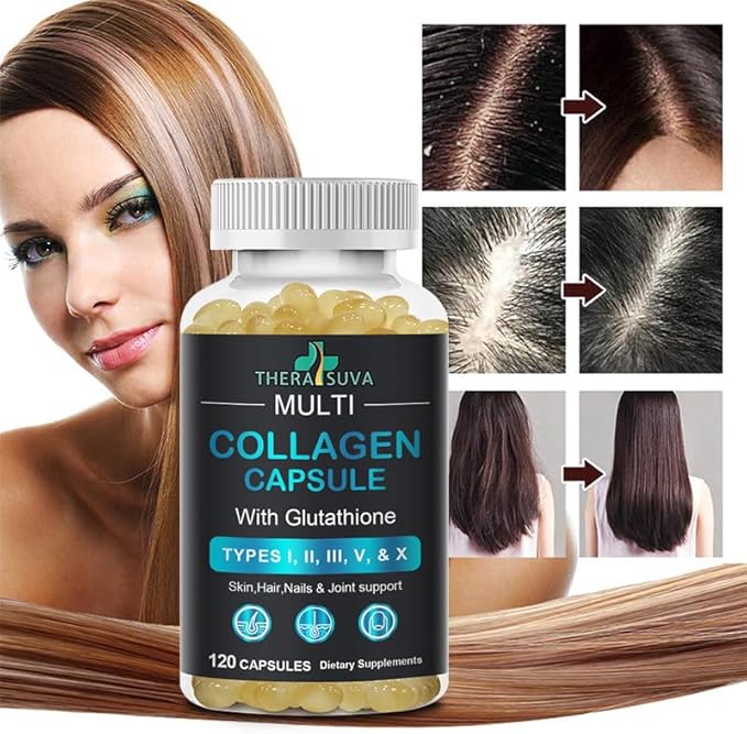 TheraSuva Complete Multi Collagen Complex – Types I, II, III, V & X + Biotin & Vitamin C – Hair, Skin, Nails & Joint Support, 2 Month Supply, 120 Softgels