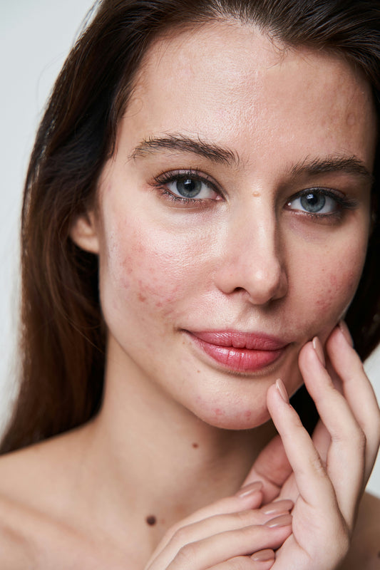 The Connection Between Gut Health and Skin Glow