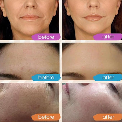 GLEOW Retinol Serum for Face with Hyaluronic Acid, Retinol for Face Is Suitable for All Skin Types, Hydrating Serum Women and Men Plumps Youthful Appearance 2oz
