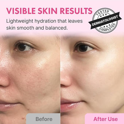 Hanskin Hyaluron Skin Essence Toner – Korean Hydrating Toner for Glass Skin | Hyaluronic Acid & Collagen | Lightweight Moisturizing Astringent for Dry, Sensitive & Dull Skin | K-Beauty (5.07 fl oz)