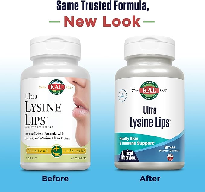 KAL Ultra Lysine Lips Supplement Tablets - 1500 mg of L-Lysine per Serving, Contains Essential Vitamin C, Red Marine Algae, & Zinc, Healthy Immune and Skin Support for Men and Women - 60 Count Tablets
