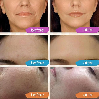 GLEOW Retinol Serum for Face, Vitamin C with Hyaluronic Acid Face Serum for Women and Men, Glow Skin Care Set Total Package Targets Appearance of Uneven Skin Tone and Dryness 3x1oz
