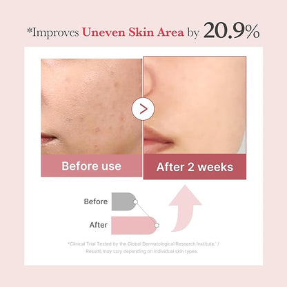 medicube Exosome Shot PDRN Pink Collagen 7,500 PPM Spicule Facial Serum | Liquid Skin Booster | Exosome, Salmon DNA Spicules | Uneven Skin Tone, Pore Care, Skin Texture | Korean Skincare, 1.01 fl.oz
