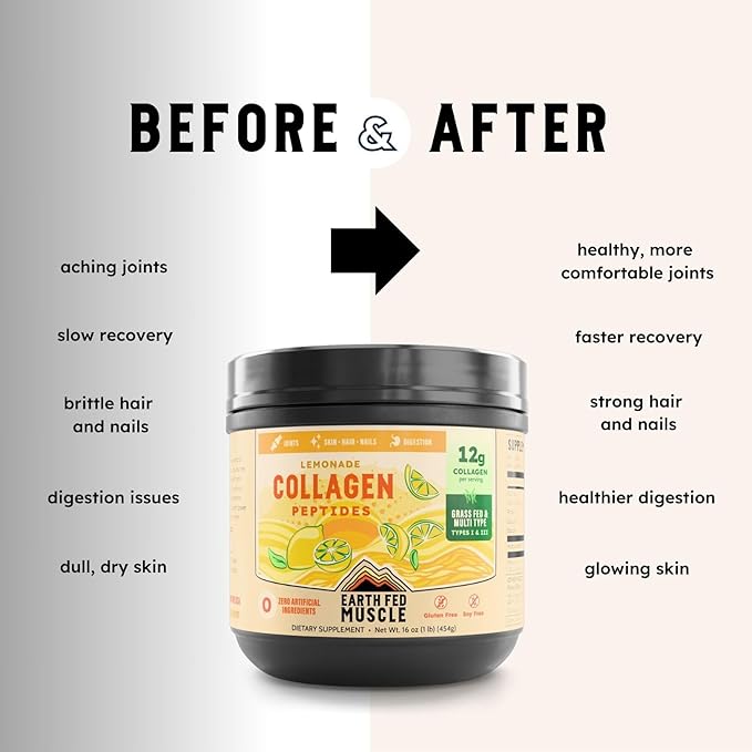 Earth Fed Muscle Lemonade Collagen Powder – Grass Fed Hydrolyzed Collagen for Women & Men - Healthy Bones, Skin & Hair - Types 1 & 3 Collagen Powder, 12g Per Serving, 33 Servings
