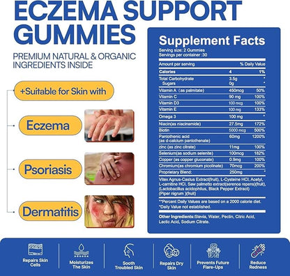 Sugar Free Eczema Treatment Gummies - USA Made - 50+ Vitamins & Probiotics for Clear, Hydrated Skin - Soothes Itching, Calms Redness & Boosts Skin Health (60 Gummies)