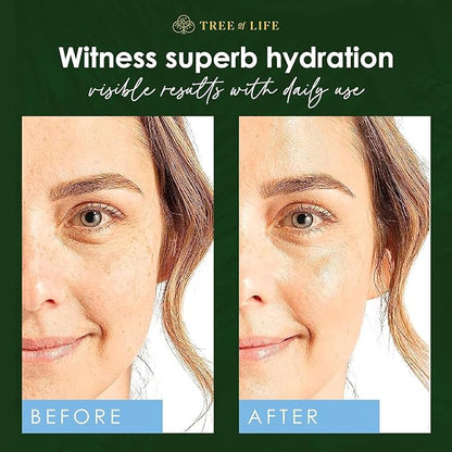 Tree of Life Beauty Hyaluronic Acid Serum, Skin Brightening Face Oil for Dark and Age Spots, Facial Serums for Dry and Sensitive Skin Care with Vitamin E for Soft Smooth Skin, 1 Fl Oz