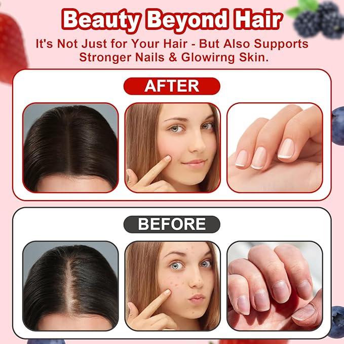 Lumin Hair Growth Gummies – Daily Hair Nourishment with Biotin, Collagen & Botanical Extracts – Supports Thicker, Stronger & Healthier-Looking Hair – Mixed Berry Flavor, 60 Gummies