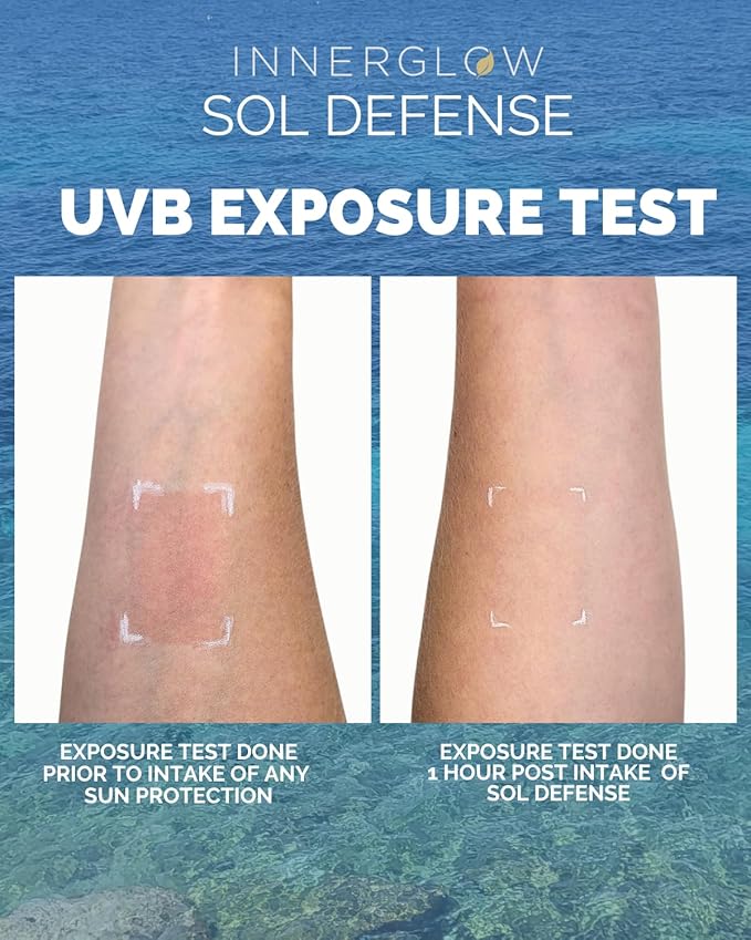 Inner Glow Sol Defense Gummies – Dermatologist & Plastic Surgeon-Formulated Skin Resilience Vitamin Supplement with Polypodium Leucotomos & Niacinamide, Passion Fruit Flavor, 60 Sugar-Free Gummies