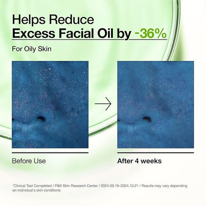 Anua Azelaic Acid 10 Hyaluron Redness Soothing Serum, Facial Serum for Blemish-Prone & Oily-Prone Skin, Lightweight & Hydrating Blemish Care, Hyaluronic Acid, Korean Skincare, 1.01 fl oz.