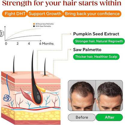 Saw Palmetto Gummies for Hair Growth & Hormone Balance – Vegan DHT Blocker for Women & Men, Supports Prostate Health, PCOS & Testosterone Wellness – Gluten-Free Herbal Supplement – 300mg Extract