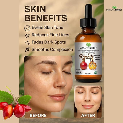 Pure Carrier and Essential Oils for Skin Care, Hair, Body Moisturizer for Face-Anti Aging Skin Care (Rosehip Organic, 4oz)