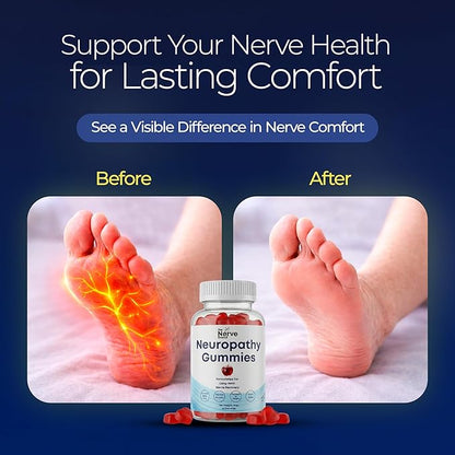 The Nerve Brand Neuropathy Support Gummies, 600 mg R Alpha Lipoic Acid Gummies with B1 B6 B12 and Lion’s Mane, Sugar Free Daily Nerve Health Supplement, 30 Day Supply
