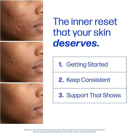 Clear Skin Supplement with Zinc, DIM & Probiotics | 3-in-1 Balance, Glow & Health Skin Support | Triple Action Hyaluronic Acid, Niaciminide & Vitamins for Hormone, Complexion & Gut Support | 60 Ct