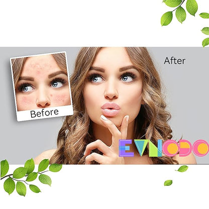 2 PCS Premium Yoni,Natural Feminine Care for pH Balance,Herbal Organic Ingredients,Hydration&Odor Control,Handmade Vegan,Daily Intimate Hygiene with Bubble Foam Net