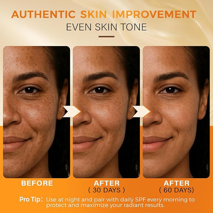QOOQ Turmeric Kojic Acid Soap for Dark Spots Remover – Facial Cleansing Bar with Vitamin C, Retinol, Collagen, Vitamin E, Glycerin, Shea Butter & Castile Olive Oil – Soap for Women & Men (120g x 2)