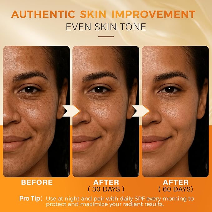 QOOQ Turmeric Kojic Acid Soap for Dark Spots Remover – Facial Cleansing Bar with Vitamin C, Retinol, Collagen, Vitamin E, Glycerin, Shea Butter & Castile Olive Oil – Soap for Women & Men (100g)