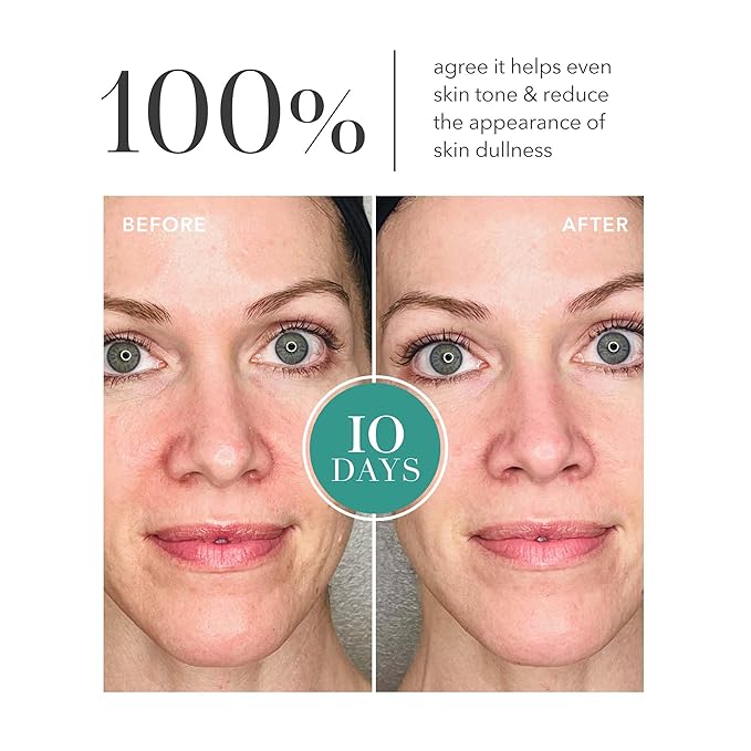 Algenist GENIUS Liquid Collagen Essence - Liquid Collagen Serum with Patented Alguronic Acid to Help Improve Skin Bounce, Elasticity & Radiance (100ml)