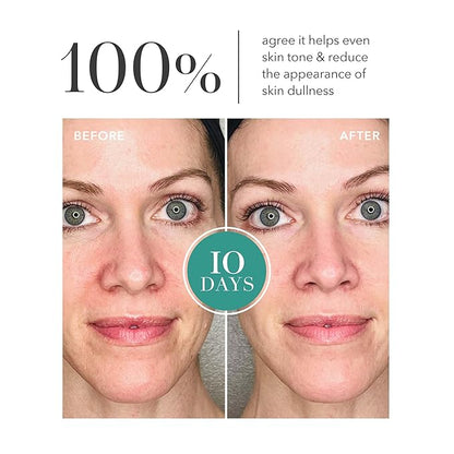 Algenist GENIUS Liquid Collagen Essence - Liquid Collagen Serum with Patented Alguronic Acid to Help Improve Skin Bounce, Elasticity & Radiance (100ml)