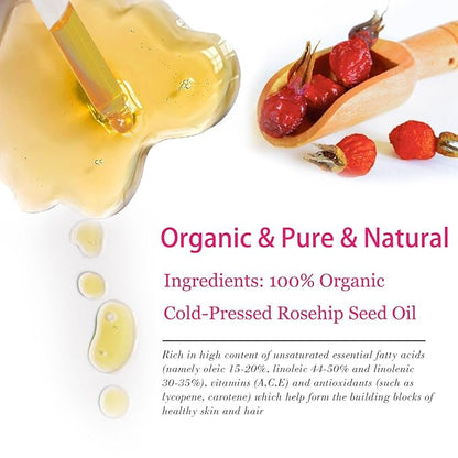 Organic Rosehip Seed Oil for Face, USDA Certified, Cold Pressed, Unrefined, 100% Pure Natural Rose Hip Oil for Anti-Aging, Acne Scar Treatment, Skin & Hair Care, Gua Sha Massage, 1 fl.oz / 30ml
