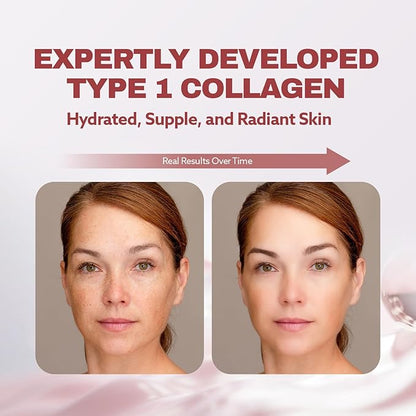 ILO Liquid Collagen Drink – 3,000mg Type 1 Marine Collagen with Biotin & Ceramide | Skin Glow & Hydration | Orange Flavor | 8 Bottles – Korean Beauty Supplement