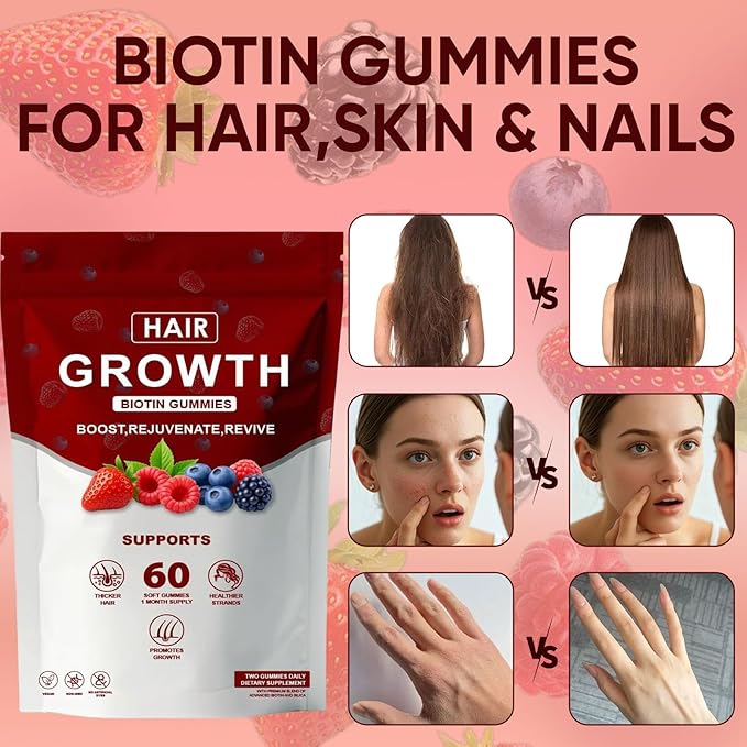 Lumin Hair Growth Gummies – with Biotin, Vitamin C & E, Rosemary, Saw Palmetto – Supports Healthy Hair Growth & Strength, Skin & Nail Care – Mixed Berry Flavor, 60 Gummies (1)