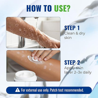 Antifungal Cream for Jock Itch: 2% Miconazole and Herbal Formula for Itchy Skin Relief Extra Strength - Cures Ringworm Athletes Foot Tinea Versicolor 100g