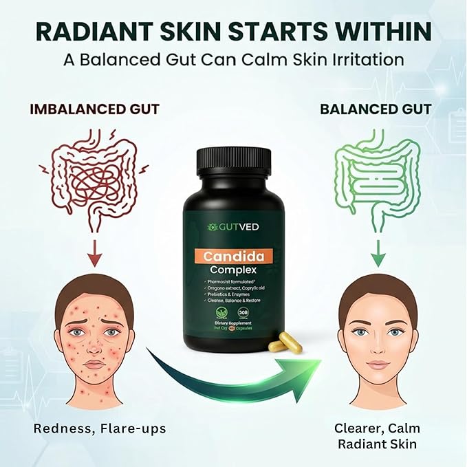Candida Complex with Caprylic Acid for Men & Women – Anti Overgrowth, Balance and Restore Supplement for Yeast, Healthy Gut Flora & Skin with 30B/g Probiotic, Oregano, Senna - 1 Month Supply