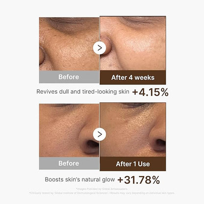 medicube Deep Vitamin C Capsule Serum | Hydrating Vitamin C Serum for Dull & Uneven-Looking Skin with Visible Concerns | Liposome Capsules for Smooth, Radiant Texture | Korean Skincare 1.01 fl.oz