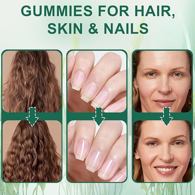 Sea Moss Gummies for Hair Loss，Hair Loss Gummies with Organic Sea Moss，Pearl Powder & Aloe Vera,Vitamin C, Vitamin E, Supports Hair & Skin Wellness Dietary Supplement — 60 Gummies