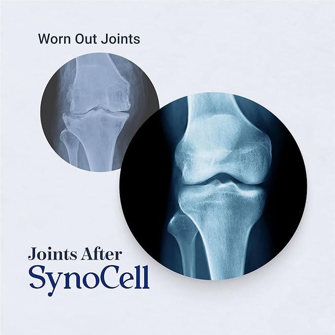 Synocell Glucosamine Chondroitin Complex 2 Pack Back, Neck, and Joint Support Supplement with Boswellia, Quercetin, & MSM - Renew Your Joints from the Inside Out - Move with Freedom and Ease
