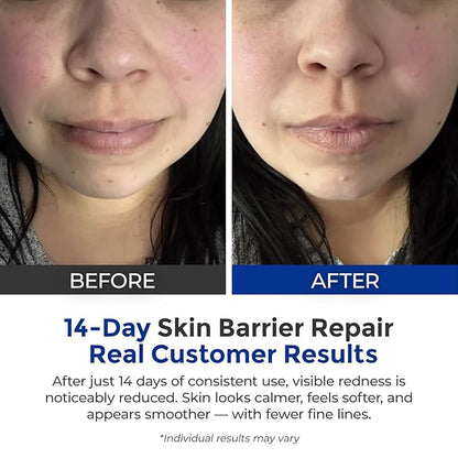 Intensive Repair Serum, 15%Hyaluronic Acid for Sensitive Skin Anti Aging Ultra Hydrating Serum for Face Calming Barrier Repair Redness Relief with Ceramides Centella 30Vials Daily Travel Care