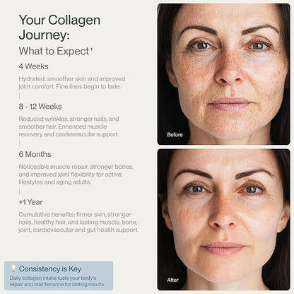 Collagen Peptides Powder Grass-Fed Pasture-Raised Hydrolyzed Collagen Powder, Type I & III Hair, Nails, Skin and Joints, Non-GMO, Paleo & Keto, Unflavored, 16 Fl oz. 45 Servings