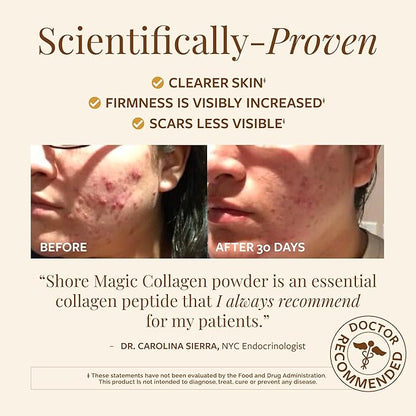 Shore Magic Premium Marine Collagen Powder Types I-IV – Wild Fish, Hydrolyzed Peptides, Unflavored, 9g Protein Per Serving – Supports Youthful Skin, Hair, Nails & Joints, 30-Day Supply