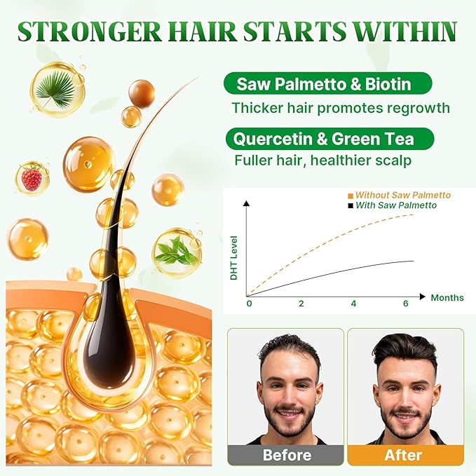 Saw Palmetto Gummies 600mg Saw Palmetto Supplement with Pumpkin Seed Oil, Biotin, Prostate Health Supplements for Men, Advanced DHT Blocker, Hair & Urinary Health Support, Raspberry Flavor, 60 Counts
