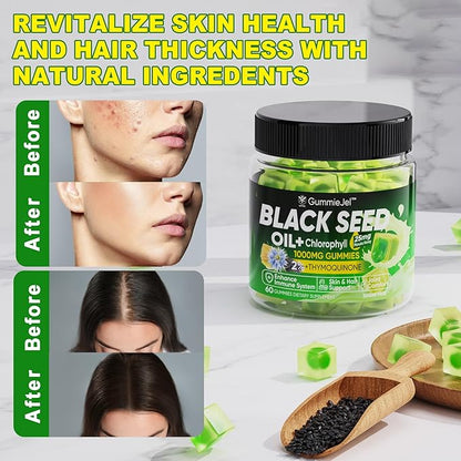 Black Seed Oil Gummies & Chlorophyll, Biotin 500mcg with Hydrolyzed Collagen, Raw Manuka Honey, Organic Cold Pressed - Ultimate Absorption for Skin, Hair & Nails, Digestive, Overall Health, 1 Pack