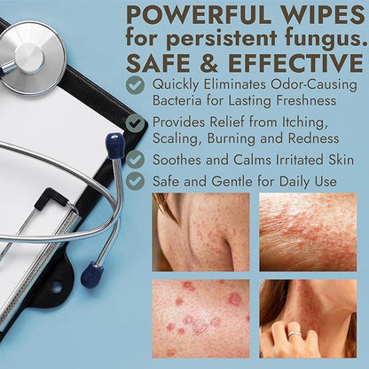 Body Wipes for Men & Women | Cleansing Body Wipes for Wrestling, Combat, Gym, Camping I Medicated with 1% Tolnaftate, Tea Tree Oil | Treats Ringworm, Jock Itch, Athlete's Foot | 40 Wipes