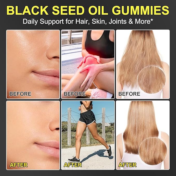 Black Seed Oil Gummies,Contains 500mg of Cold-Pressed Black Seed Oil,Promotes Digestion | Gluten Free | Non-GMO | Pectin Base,Hair Strength & Skin Hydration,90 Gummies