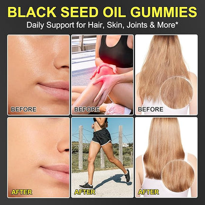 Black Seed Oil Gummies,Contains 500mg of Cold-Pressed Black Seed Oil,Promotes Digestion | Gluten Free | Non-GMO | Pectin Base,Hair Strength & Skin Hydration,90 Gummies