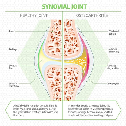 Fluid Motion - Hip & Joint Support for Dogs - Liquid Hyaluronic Acid - Mobility, Comfort and Joint Supplement for Senior Dogs - Apple Flavor - Glucosamine Alternative (60-120+ Day Supply)