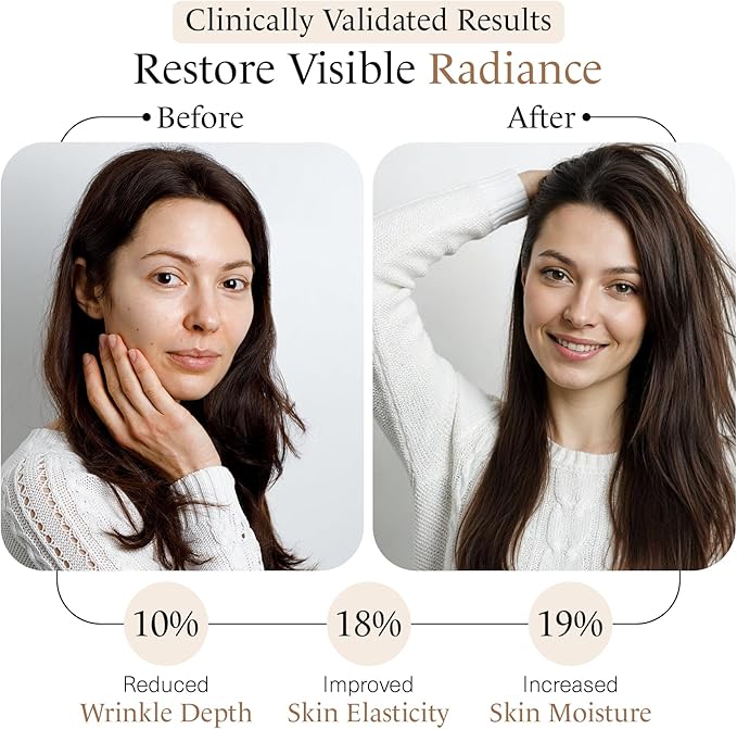 momentM Revitalize Skin Hydration Supplement, Vegan Collagen Alternative with Ceramosides & Astaxanthin - Hyaluronic Acid Supplements for Anti-Aging, Wrinkles & Fine Lines, 60 Hyaluronic Acid Capsules