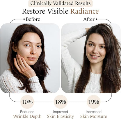 momentM Revitalize Skin Hydration Supplement, Vegan Collagen Alternative with Ceramosides & Astaxanthin - Hyaluronic Acid Supplements for Anti-Aging, Wrinkles & Fine Lines, 60 Hyaluronic Acid Capsules
