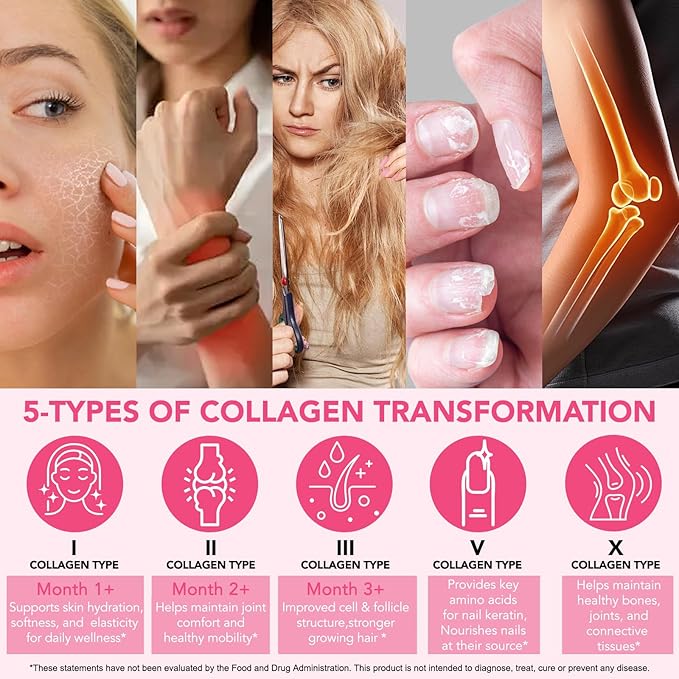 Multi Collagen Peptides Powder, 1 lb Unflavored Hydrolyzed Collagen Types I, II, III, V, X，16 oz (41 Servings)-Hyaluronic Acid Power,Grass Fed Collagen Supplements for Women and Men, Non GMO