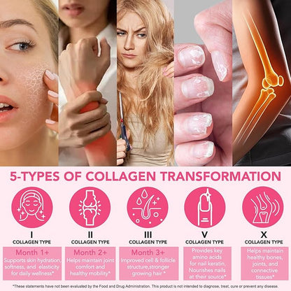 Multi Collagen Peptides Powder, 1 lb Unflavored Hydrolyzed Collagen Types I, II, III, V, X，16 oz (41 Servings)-Hyaluronic Acid Power,Grass Fed Collagen Supplements for Women and Men, Non GMO