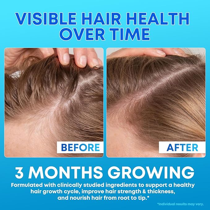Biotin Gummies 10,000mcg with Collagen - 23-in-1 Hair Growth Gummies for Women & Men - Hair Skin and Nails Gummies with Keratin & Saw Palmetto - Sugar Free Non-GMO, Blueberry, 90 Count