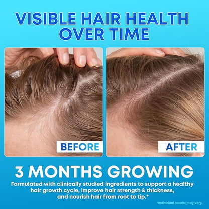 Biotin Gummies 10,000mcg with Collagen - 23-in-1 Hair Growth Gummies for Women & Men - Hair Skin and Nails Gummies with Keratin & Saw Palmetto - Sugar Free Non-GMO, Blueberry, 90 Count