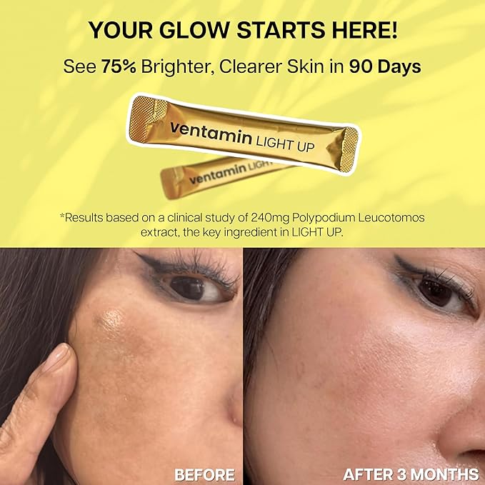 Light Up – Antioxidant Skin-Brightening Supplement with Vitamin C, Plant-Based Extracts & Hydrating Support – Lemon Green Tea Flavor – for Even Tone, Dark Spot Reduction & Glow – 30 Sachets