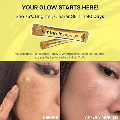 Light Up – Antioxidant Skin-Brightening Supplement with Vitamin C, Plant-Based Extracts & Hydrating Support – Lemon Green Tea Flavor – for Even Tone, Dark Spot Reduction & Glow – 30 Sachets