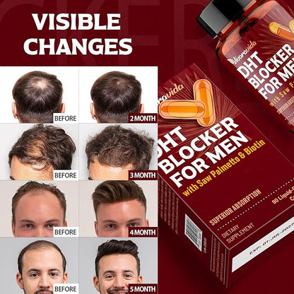 DHT Blocker for Men | Hair Growth Vitamins Supplement with Saw Palmetto & Biotin - Hair Regrowth - Natural Hair Loss Supplements Liquid-Filled - Proprietary Herbal Blends (180 Capsules)