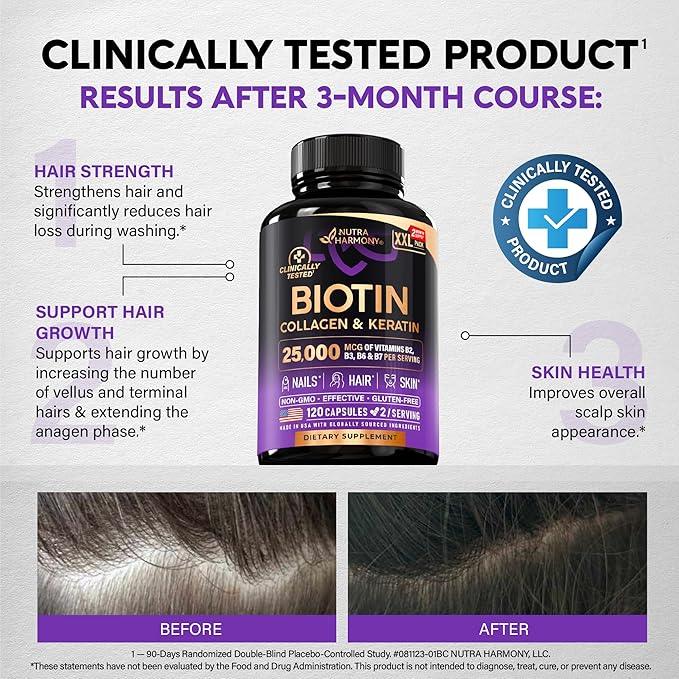Biotin | Collagen | Hyaluronic Acid | Keratin - Clinically Tested Supplement - Hair Growth Support, Skin & Nails - 25000 mcg Vitamins B2, B3, B6 & B7 + B1 - Made in USA - Women & Men | 120 Capsules