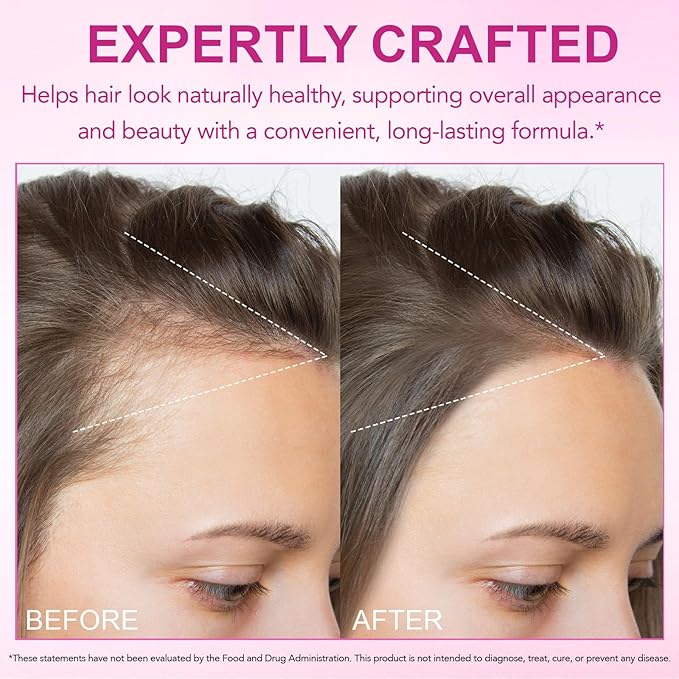Hair Skin Nail Multivitamin & Biotin, 5000 mcg Biotin of Per Serving with Vitamin A/C/E/B Vitamins/Collagen/Keratin/Argan Oil for Hair/Nail Growth, Radiant Skin Support - for Women & Men|400 Pcs